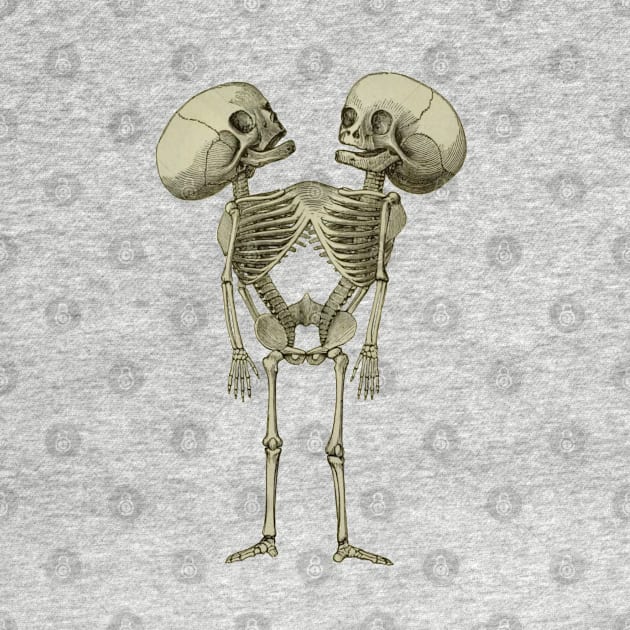 Siamese Twins Skeleton by blackjackdavey